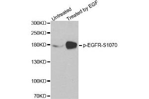 Western Blotting (WB) image for anti-Epidermal Growth Factor Receptor (EGFR) (pSer1070) antibody (ABIN1870119) (EGFR antibody  (pSer1070))