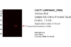 Western Blotting (WB) image for anti-3-Oxoacid CoA Transferase 1 (OXCT1) (Middle Region) antibody (ABIN311042) (OXCT1 antibody  (Middle Region))