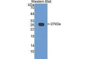 Western Blotting (WB) image for anti-Transglutaminase 3 (E Polypeptide, Protein-Glutamine-gamma-Glutamyltransferase) (TGM3) (AA 468-693) antibody (ABIN1078610) (TGM3 antibody  (AA 468-693))
