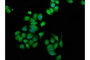 Immunofluorescence staining of PC-3 cells with ABIN7144251 at 1:100, counter-stained with DAPI. (Ankyrin G antibody  (AA 3540-3719))