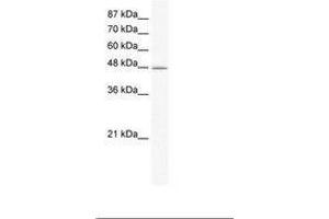 Image no. 1 for anti-DNA Methyltransferase 1-Associated Protein 1 (DMAP1) (AA 150-199) antibody (ABIN203163) (DMAP1 antibody  (AA 150-199))