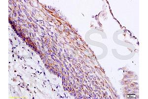 Formalin-fixed and paraffin embedded rat skin tissue labeled with Anti-PER2/Period circadian protein 2 Polyclonal Antibody, Unconjugated (ABIN751258) at 1:200 followed by conjugation to the secondary antibody and DAB staining (PER2 antibody  (AA 751-850))