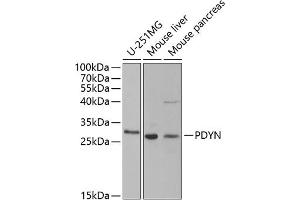 Western blot analysis of extracts of various cell lines, using PDYN antibody (ABIN6129606, ABIN6145418, ABIN6145419 and ABIN6221524) at 1:1000 dilution. (PDYN antibody  (AA 21-254))