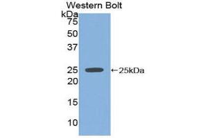 Western Blotting (WB) image for anti-Sprouty Homolog 2 (SPRY2) (AA 116-304) antibody (ABIN1860621) (SPRY2 antibody  (AA 116-304))