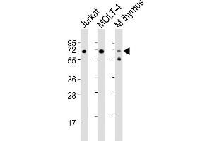 Lane 1: Jurkat Cell lysates, Lane 2: MOLT-4 Cell lysates, Lane 3: mouse thymus Cell lysates, probed with Zap70 (1484CT290. (ZAP70 antibody)