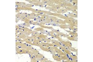 Immunohistochemistry (IHC) image for anti-BCL2-Antagonist/killer 1 (BAK1) (AA 62-112) antibody (ABIN6213662) (BAK1 antibody  (AA 62-112))