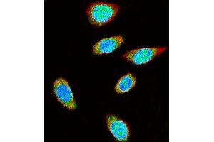 Confocal immunofluorescent analysis of SUMO1 Antibody f with  cell followed by Alexa Fluor 488-conjugated goat anti-rabbit lgG (green). (SUMO1 antibody)