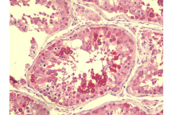 CASKIN2 antibody  (N-Term)