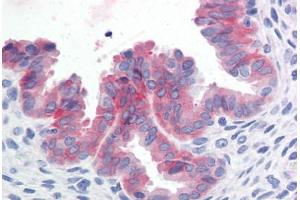 Human Uterus (formalin-fixed, paraffin-embedded) stained with c-Met antibody ABIN351534 at 10 ug/ml followed by biotinylated anti-mouse IgG secondary antibody ABIN481714, alkaline phosphatase-streptavidin and chromogen. (c-MET antibody  (Cytoplasmic Domain))