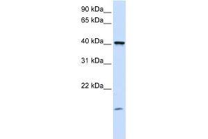 WB Suggested Anti-TMEM79 Antibody Titration:  0. (TMEM79 antibody  (C-Term))