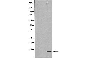 Western blot analysis of extracts of Jurkat, using MIF antibody. (MIF antibody  (C-Term))
