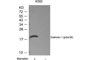 Western blot analysis of extracts from K562 cells untreated or treated with starvation using Stathmin 1(Phospho-Ser38) Antibody. (Stathmin 1 antibody  (pSer38))