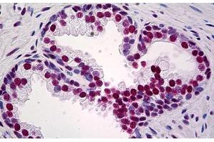 Human Prostate: Formalin-Fixed, Paraffin-Embedded (FFPE) (KAP1 antibody  (AA 379-524))