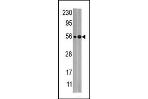 Western blot analysis of anti-NMD3 Pab (ABIN388665 and ABIN2838600) in mouse heart (left) and T47D (right)tissue lysates (35 μg/lane). (NMD3 antibody  (C-Term))