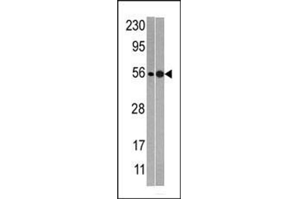 NMD3 anticorps  (C-Term)