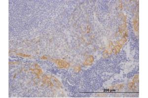 Immunoperoxidase of purified MaxPab antibody to KRT19 on formalin-fixed paraffin-embedded human tonsil. (Cytokeratin 19 antibody  (AA 1-400))