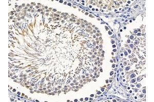 ABIN6258257 and ABIN6275216 at 1/100 staining rat testis tissue by IHC-P. (LSP1 antibody  (C-Term))