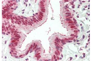 Rabbit Anti-EXOSC10 antibody  Formalin Fixed Paraffin Embedded Tissue: Human Lung, Respiratory Epithelium Primary antibody Concentration: 1:100 Secondary Antibody: Donkey anti-Rabbit-Cy3 Secondary Antibody Concentration: 1:200 Magnification: 20x Exposure Time: 0. (EXOSC10 antibody  (C-Term))