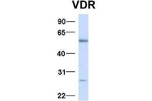 Host:  Rabbit  Target Name:  VDR  Sample Type:  Human Fetal Liver  Antibody Dilution:  1. (Vitamin D Receptor antibody  (N-Term))