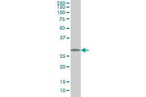 MMP26 monoclonal antibody (M01), clone 6C6 Western Blot analysis of MMP26 expression in HL-60 . (MMP26 antibody  (AA 152-261))