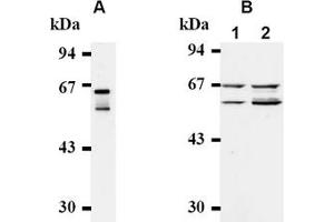 Western Blotting (WB) image for anti-Cell Division Cycle 25 Homolog A (S. Pombe) (CDC25A) antibody (ABIN487482) (CDC25A antibody)