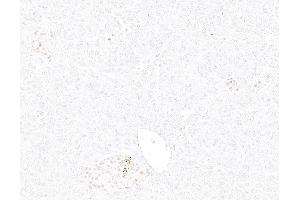 Immunohistochemistry (IHC) image for anti-Insulinoma-Associated 1 (INSM1) (AA 75-125) antibody (ABIN7795670) (Recombinant INSM1 antibody  (AA 75-125))