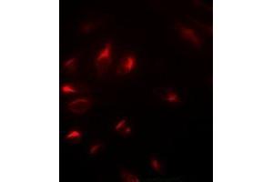 Immunofluorescent analysis of NELF-E staining in U2OS cells. (RDBP antibody)