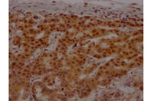 Immunohistochemistry (IHC) image for anti-Poly (ADP-Ribose) Polymerase 1 (PARP1) antibody (ABIN7127667)