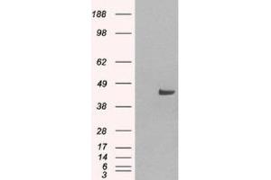 Western Blotting (WB) image for anti-Sorting Nexin 16 (SNX16) (N-Term) antibody (ABIN2466293) (SNX16 antibody  (N-Term))