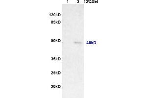 Lane 1: rat brain lysates Lane 2: human colon carcinoma lysates probed with Anti MAGEA11 Polyclonal Antibody, Unconjugated (ABIN721285) at 1:200 in 4 °C. (MAGEA11 antibody  (AA 12-120))