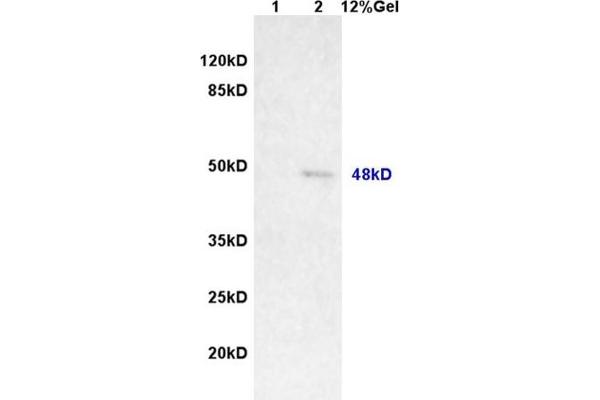 MAGEA11抗体（AA 12-120）