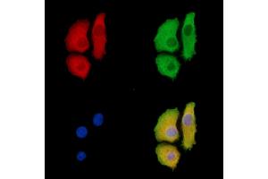 ABIN6260069 and ABIN6278660 staining Hela cells by IF/ICC.