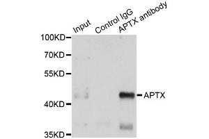 Immunoprecipitation analysis of 150 μg extracts of A549 cells using 3 μg APTX antibody (ABIN5973100).