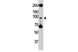 The Tlr5 polyclonal antibody  is used in Western blot to detect TLR5 in HL-60 cell lysate. (TLR5 antibody  (C-Term))