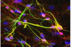 Mixed rat neuron-glial cultures stained with ABIN1842228, polyclonal antibody to -synuclein (red) and monoclonal antibody to MAP2: MAP2-4H5 (green). (SNCA antibody)