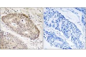 Immunohistochemistry (IHC) image for anti-Calcium Responsive Transcription Factor (CARF) (AA 311-360) antibody (ABIN2890117) (Calcium Responsive Transcription Factor (CARF) (AA 311-360) antibody)