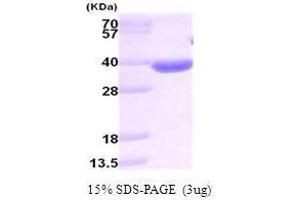 Figure annotation denotes ug of protein loaded and % gel used. (AKR1B10 Protein (AA 1-316))