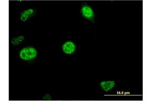 Immunofluorescence of monoclonal antibody to CDC20B on HeLa cell. (CDC20B antibody  (AA 416-515))