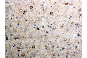 Immunohistochemistry (IHC) image for anti-Cytochrome C, Somatic (CYCS) (AA 2-105) antibody (ABIN3042783)