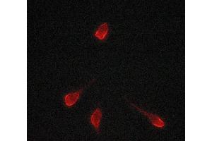Immunofluorescence (fixed cells) (IF/ICC) image for anti-Tyrosinase (TYR) antibody (ABIN6265828)