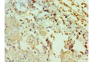 Immunohistochemistry of paraffin-embedded human epityphlon tissue using ABIN7153430 at dilution of 1:100 (GAL antibody  (AA 20-123))