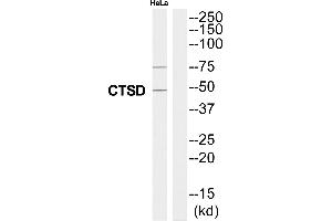 Western blot analysis of extracts from HeLa cells, using CTSD antibody. (Cathepsin D antibody  (Internal Region))
