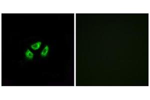 Immunofluorescence analysis of A549 cells, using SCN7A antibody. (SCN7A antibody  (Internal Region))