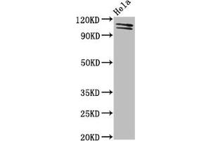 Western Blot Positive WB detected in: Hela whole cell lysate All lanes: UBA1 antibody at 2 μg/mL Secondary Goat polyclonal to rabbit IgG at 1/50000 dilution Predicted band size: 118, 114 kDa Observed band size: 118, 114 kDa (UBA1 antibody  (AA 730-881))