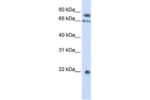 WB Suggested Anti-SENP1 Antibody Titration: 0. (SENP1 antibody  (Middle Region))