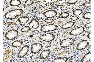 IHC analysis of RCC1 using anti-RCC1 antibody (ABIN7600024).