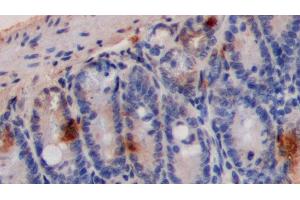 Detection of 5-HT in Mouse Colon Tissue using Polyclonal Antibody to 5-Hydroxytryptamine (5-HT)