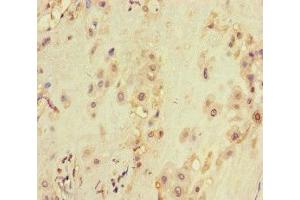 Immunohistochemistry of paraffin-embedded human placenta tissue using ABIN7175563 at dilution of 1:100 (VDAC2 antibody  (AA 2-36))