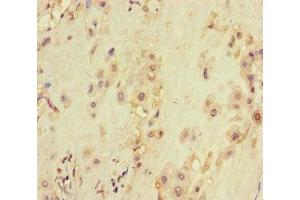 Immunohistochemistry of paraffin-embedded human placenta tissue using ABIN7175563 at dilution of 1:100