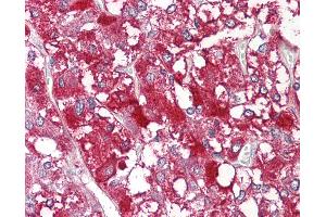 Anti-MYCBP antibody IHC of human adrenal. (MYCBP antibody  (C-Term))